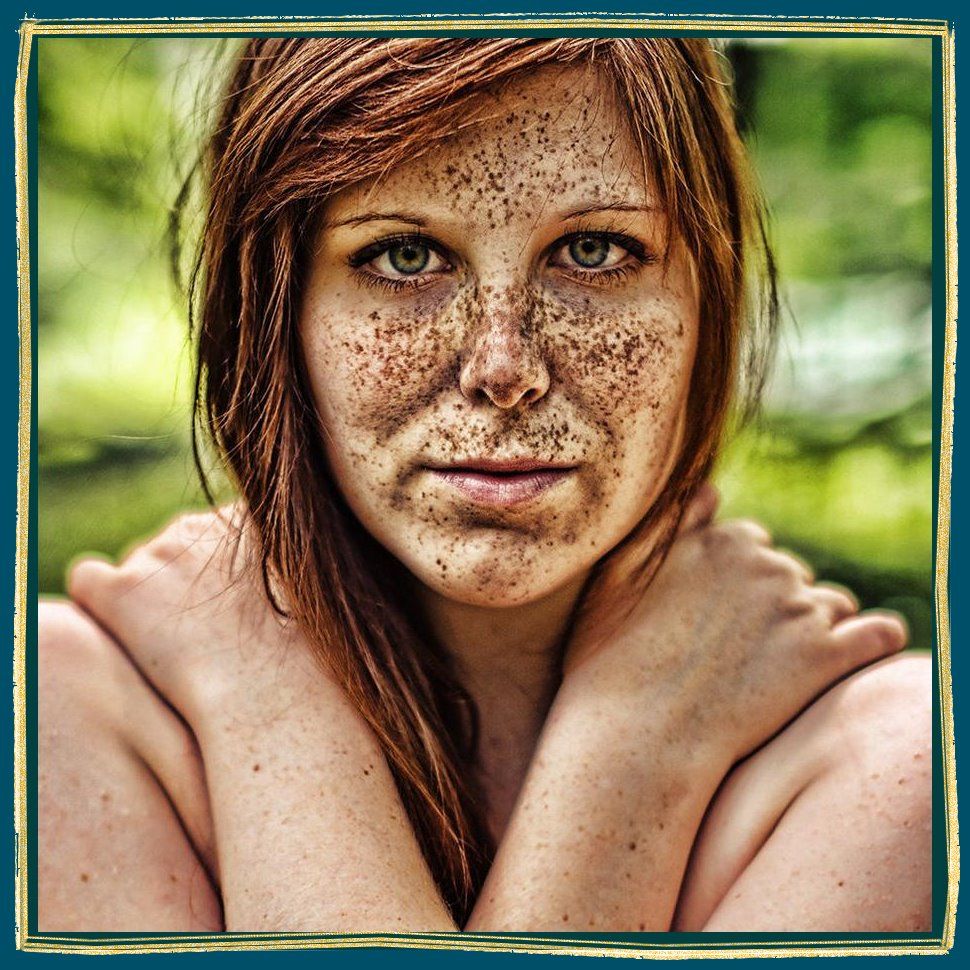 De pour quoi la pigmentation sur la personne arrive